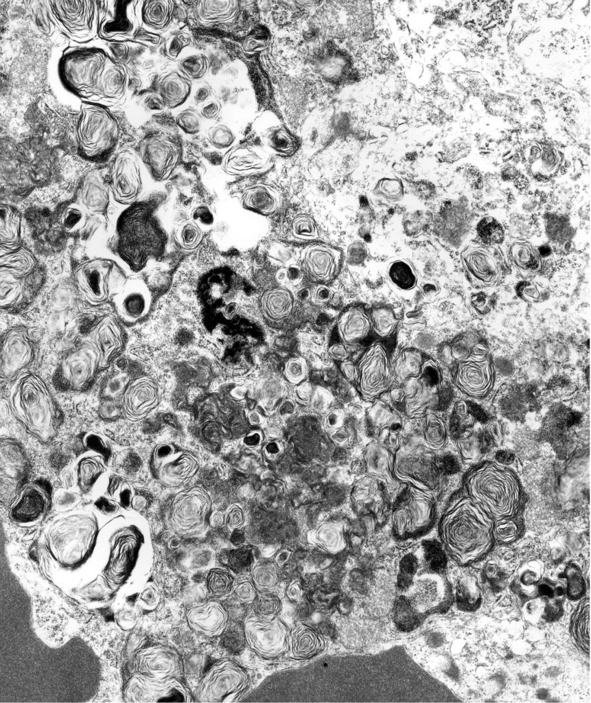 Transmission electron microscopy image.