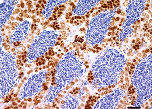 PCNA IHC of fish tissues